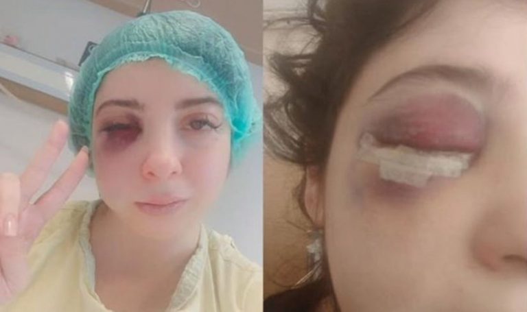 Damla yolun ortasında taciz etti: Artık yüzümün sol tarafını hissetmiyorum – son dakika Türkiye Haberleri